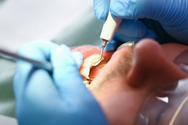 Best Emergency Denture Repair in Green Hill, TN
