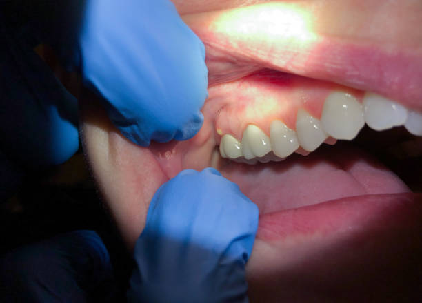 Best Broken or Chipped Tooth Repair in Green Hill, TN